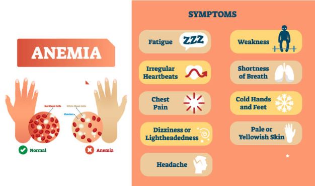 anemia symptoms